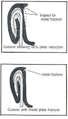 Cutover graphic showing both 50% reduction and a fracture