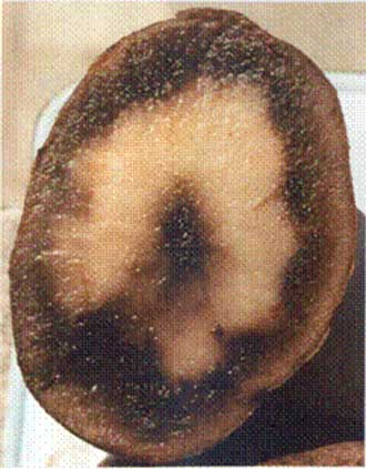 2 | Soft black tissue caused by freezing damage to tuber. Description follows.