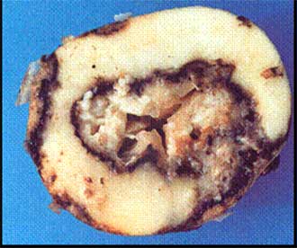 Pourriture molle – interne Erwinia carotovora. Description ci-dessous.