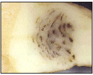 Picture 64 - Potato Mop Top Virus - internal necrosis. Description follows.