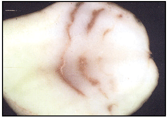 Picture 65 - Potato Mop Top Virus - internal necrosis. Description follows.