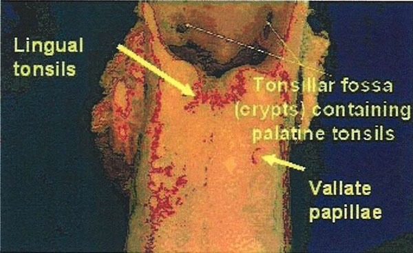 Adult Bovine Tongue with Palatine and Lingual Tonsils and Vallate Papillae